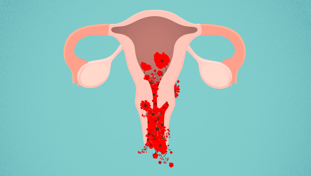 abnormal bleeding