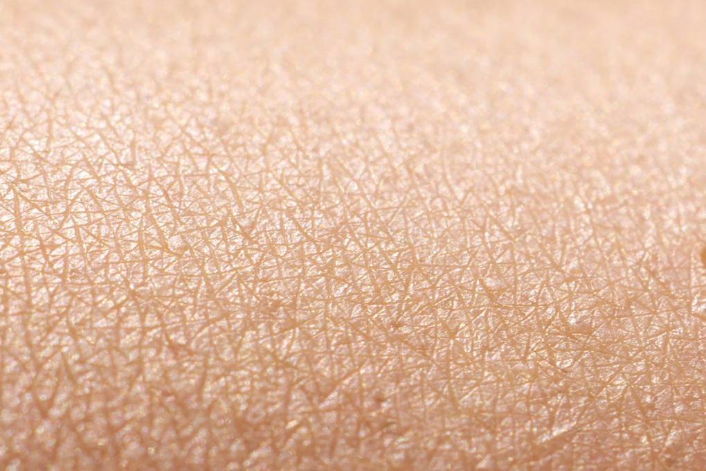 dry skin