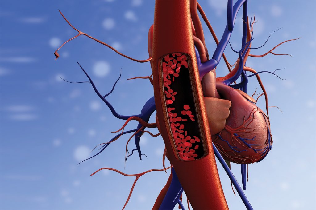 L-Carnitine- Should we use in Hypertension?