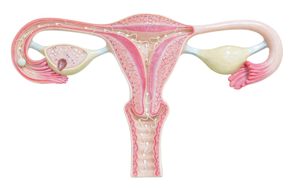 Adenomyosis