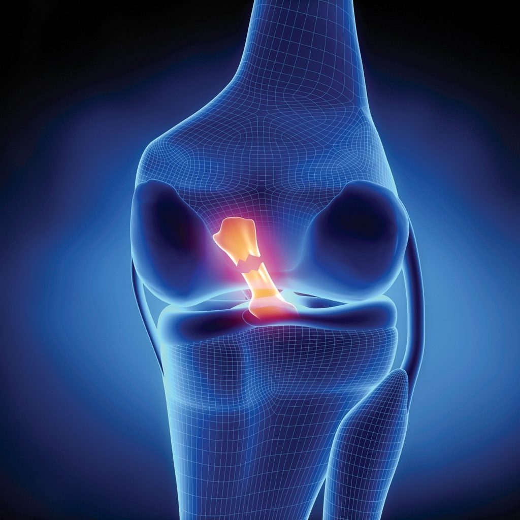 injuries responsible for knee joint pain
