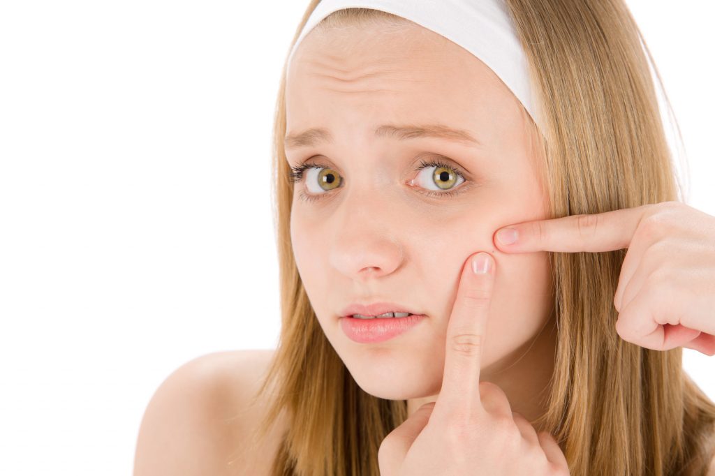 only teenagers get pimples